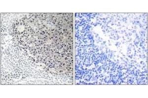 Immunohistochemistry analysis of paraffin-embedded human tonsil tissue, using Collagen IX alpha3 Antibody.