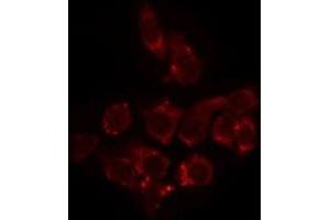 ABIN6275241 staining HeLa by IF/ICC. (SLC25A11 Antikörper  (Internal Region))