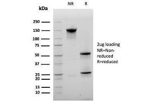 SDS-PAGE Analysis Purified CD20 Mouse Monoclonal Antibody (MS4A1/3410). (CD20 Antikörper  (AA 213-297))