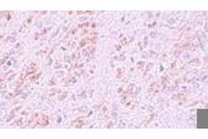 Immunohistochemistry (IHC) image for anti-VENT Homeobox (VENTX) (Middle Region) antibody (ABIN1031159) (VENTX Antikörper  (Middle Region))