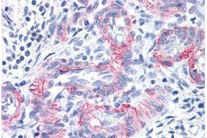 Vessels in Human Uterus: Formalin-Fixed, Paraffin-Embedded (FFPE) (MCAM Antikörper)