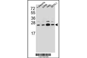 Western blot analysis in human placenta tissue and Jurkat,Hela,ZR-75-1 cell line lysates (35ug/lane). (SSR2 Antikörper  (C-Term))