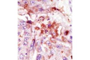 Image no. 2 for anti-Interleukin-1 Receptor-Associated Kinase 1 (IRAK1) (C-Term) antibody (ABIN360116) (IRAK1 Antikörper  (C-Term))