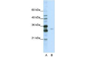 WB Suggested Anti-SFRS1  Antibody Titration: 0. (SRSF1 Antikörper  (C-Term))