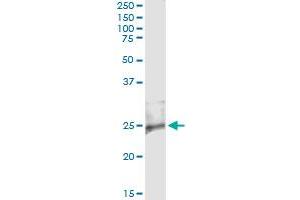 Immunoprecipitation of RASD2 transfected lysate using anti-RASD2 monoclonal antibody and Protein A Magnetic Bead , and immunoblotted with RASD2 MaxPab rabbit polyclonal antibody. (RASD2 Antikörper  (AA 1-266))