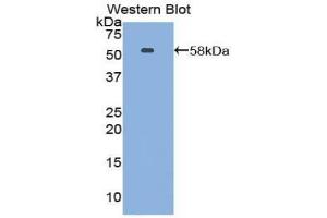 Western blot analysis of the recombinant protein. (Netrin 1 Antikörper  (AA 313-565))