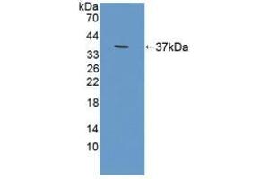 Detection of Recombinant RDX, Human using Polyclonal Antibody to Radixin (RDX) (Radixin Antikörper  (AA 5-295))