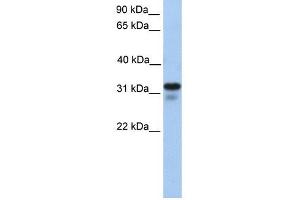 HS3ST6 antibody used at 1 ug/ml to detect target protein.