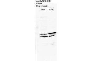 Image no. 2 for anti-Heterogeneous Nuclear Ribonucleoprotein L (HNRNPL) antibody (ABIN108560)