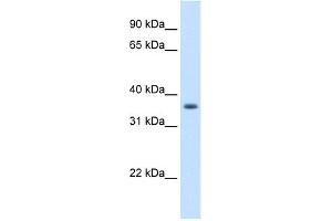 WB Suggested Anti-AKR1B10 Antibody Titration:  1.