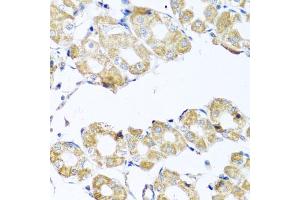 Immunohistochemistry of paraffin-embedded human stomach using COQ7 antibody (ABIN5975182) at dilution of 1/100 (40x lens). (Coq7 Antikörper)