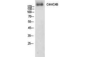 Western Blotting (WB) image for anti-Complement C4A/C4B (Internal Region) antibody (ABIN3178888) (Complement C4A/C4B (Internal Region) Antikörper)