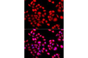 Immunofluorescence analysis of A549 cell using PRDM14 antibody. (PRDM14 Antikörper)