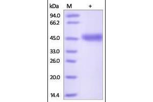 Human VSIG4, His Tag on SDS-PAGE under reducing (R) condition. (VSIG4 Protein (AA 20-283) (His tag))