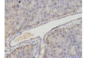 Immunohistochemistry (IHC) image for anti-Asparagine Synthetase (ASNS) antibody (ABIN1876738) (Asparagine Synthetase Antikörper)