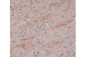Used in DAB staining on fromalin fixed paraffin- embedded Kidney tissue (IFNA2 Antikörper  (AA 24-192))