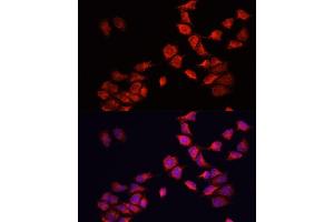 Immunofluorescence analysis of HeLa cells using BNIP3 antibody (ABIN6127502, ABIN6137620, ABIN6137621 and ABIN6221337) at dilution of 1:100. (BNIP3 Antikörper  (AA 1-164))
