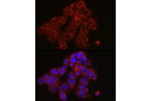 Immunofluorescence (IF) image for anti-Tyrosine Kinase 2 (TYK2) (AA 750-850) antibody (ABIN3022988)