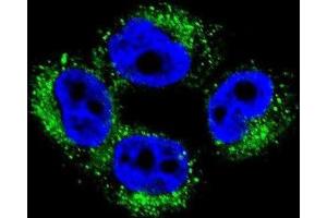 Immunofluorescence (IF) image for anti-Adaptor-Related Protein Complex 1, mu 1 Subunit (AP1M1) antibody (ABIN2996504) (AP1M1 Antikörper)