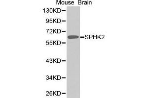 Western Blotting (WB) image for anti-Sphingosine Kinase 2 (SPHK2) (AA 1-165) antibody (ABIN1682869) (SPHK2 Antikörper  (AA 1-165))
