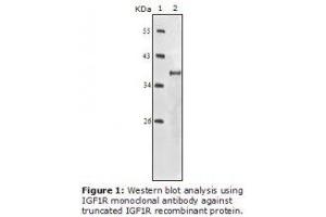 Image no. 2 for anti-Insulin-Like Growth Factor 1 Receptor (IGF1R) antibody (ABIN232138) (IGF1R Antikörper)