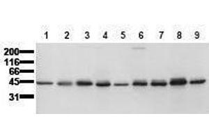 Western Blotting (WB) image for anti-Casein Kinase 1, epsilon (CSNK1E) (AA 355-380) antibody (ABIN126752) (CK1 epsilon Antikörper  (AA 355-380))