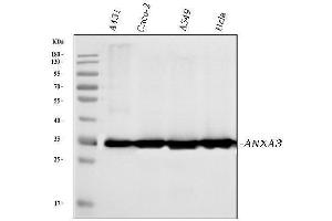 Western blot analysis of Annexin A3 using anti-Annexin A3 antibody (ABIN7602989).