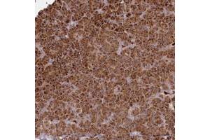 Immunohistochemical staining of human pancreas with BPIFC polyclonal antibody  shows strong cytoplasmic positivity in exocrine glandular cells. (BPIFC Antikörper)