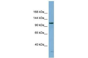 DHX15 antibody used at 1 ug/ml to detect target protein. (DHX15 Antikörper)