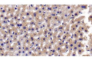 Detection of CASP3 in Mouse Liver Tissue using Polyclonal Antibody to Caspase 3 (CASP3) (Caspase 3 Antikörper  (AA 29-175))