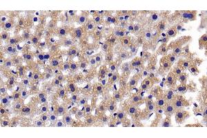 Detection of CASP3 in Mouse Liver Tissue using Polyclonal Antibody to Caspase 3 (CASP3) (Caspase 3 Antikörper  (AA 29-175))