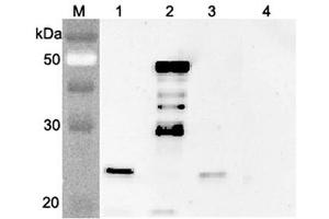 Western blot analysis using anti-FGF-21 (mouse), pAb  at 1:4'000 dilution.