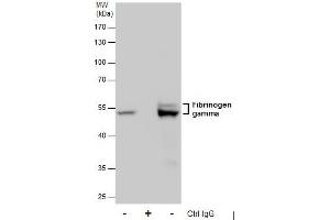 IP Image Immunoprecipitation of Fibrinogen gamma protein from HepG2 whole cell extracts using 5 μg of Fibrinogen gamma antibody, Western blot analysis was performed using Fibrinogen gamma antibody, EasyBlot anti-Rabbit IgG  was used as a secondary reagent. (FGG Antikörper)