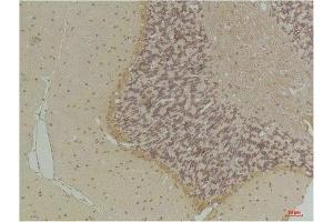 Immunohistochemical analysis of paraffin-embedded Rat BrainTissue using GABA Transporter 1 Rabbit pAb diluted at 1:200. (SLC6A1 Antikörper)