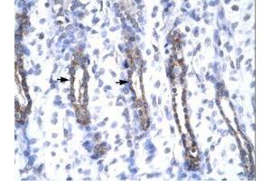Image no. 2 for anti-Matrix Metallopeptidase 19 (MMP19) (AA 56-105) antibody (ABIN6735807) (MMP19 Antikörper  (AA 56-105))