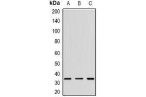 Western blot analysis of CD152 expression in K562 (A), mouse spleen (B), rat thymus (C) whole cell lysates. (CTLA4 Antikörper)