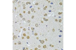 Immunohistochemistry of paraffin-embedded mouse brain using RNASEL antibody. (RNASEL Antikörper)