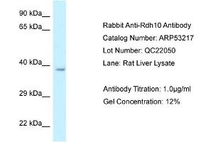 Western Blotting (WB) image for anti-Retinol Dehydrogenase 10 (All-Trans) (RDH10) (C-Term) antibody (ABIN2785295)