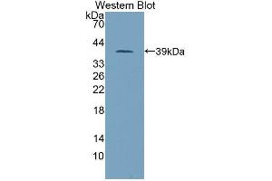 Western blot analysis of the recombinant protein. (PITPNB Antikörper  (AA 2-271))