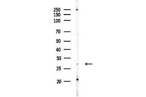 anti-Ribosomal Protein S4, Y-Linked 1 (RPS4Y1) antibody