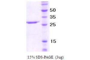 SDS-PAGE (SDS) image for Natural Cytotoxicity Triggering Receptor 1 (NCR1) (AA 22-255) protein (ABIN666806)