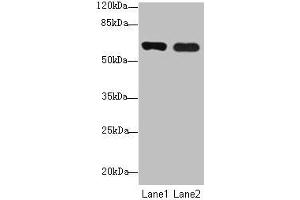 Western blot All lanes: SPTLC3 antibody at 0. (SPTLC3 Antikörper  (AA 1-58))