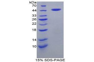SDS-PAGE (SDS) image for Corticotropin Releasing Hormone (CRH) (AA 40-195) protein (His tag,GST tag) (ABIN1525397)