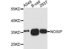 Western blot analysis of extracts of various cells, using NOSIP antibody. (NOSIP Antikörper)