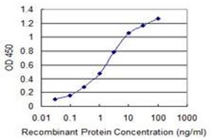 Detection limit for recombinant GST tagged SIX4 is 0. (SIX4 Antikörper  (AA 672-780))