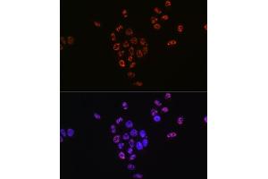 Immunofluorescence (IF) image for anti-Ribosomal Protein S6 Kinase, 70kDa, Polypeptide 1 (RPS6KB1) (pSer424), (pThr421) antibody (ABIN6136296)