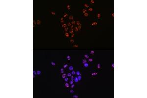 Immunofluorescence analysis of HeLa cells using Phospho-p70 S6 Kinase 1-T421/S424 antibody (ABIN6135340, ABIN6136296, ABIN6136297 and ABIN7101878). (RPS6KB1 Antikörper  (pSer424, pThr421))