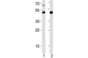 Western blot analysis of lysate from 1) mouse heart and 2) rat stomach tissue lysate using Gata6 antibody at 1:1000. (GATA6 Antikörper  (C-Term))