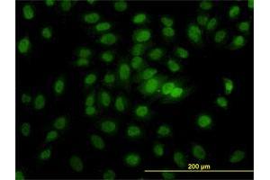 Immunofluorescence of monoclonal antibody to CSE1L on HeLa cell. (Exportin 2 Antikörper  (AA 872-971))