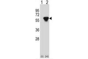 Western blot analysis of PRKAR2B (arrow) using rabbit polyclonal PRKAR2B Antibody (Center) .